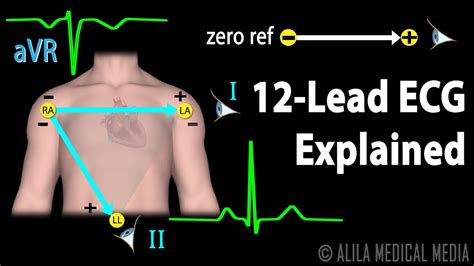 what is ecg 12 lead test.